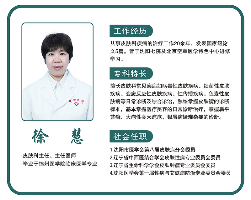 徐慧.jpg